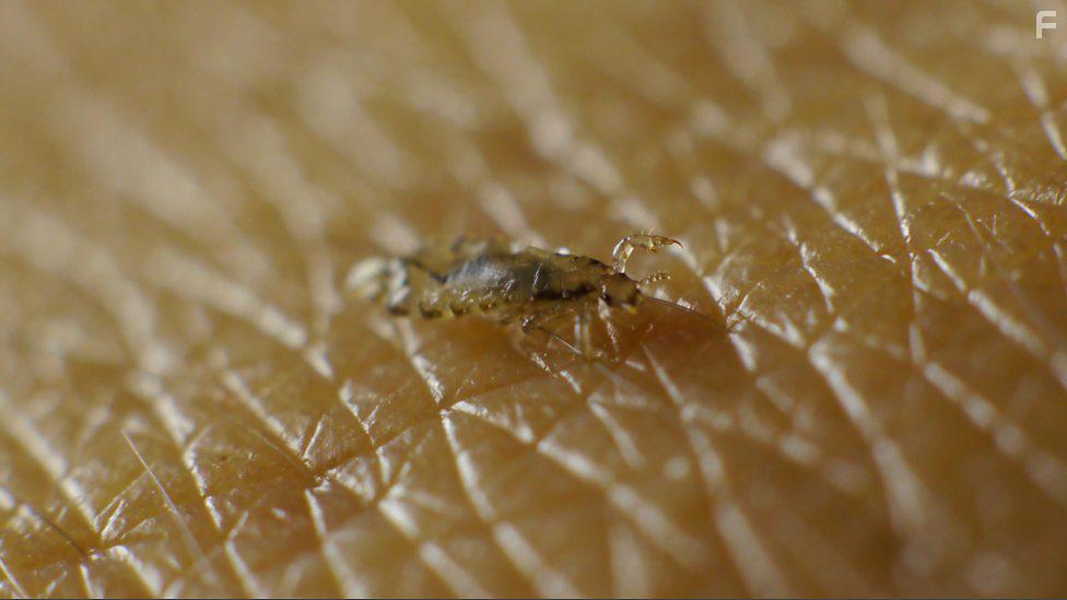 BBC: Зараженный. Жизнь с паразитами #1