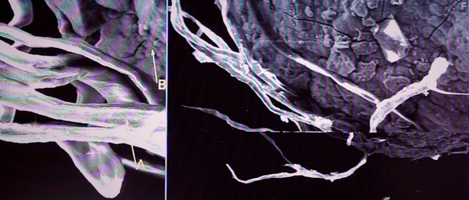 Пациент номер семнадцать #6