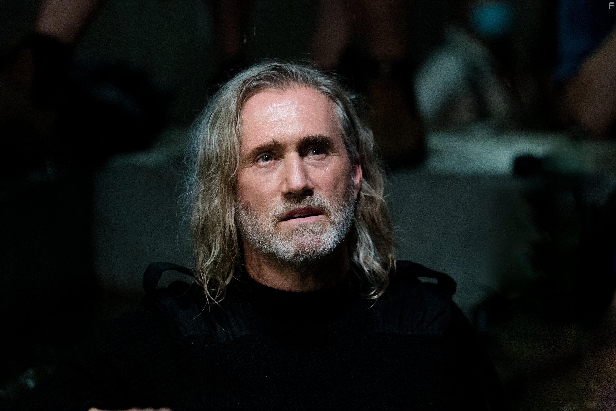 Обморожения головного мозга