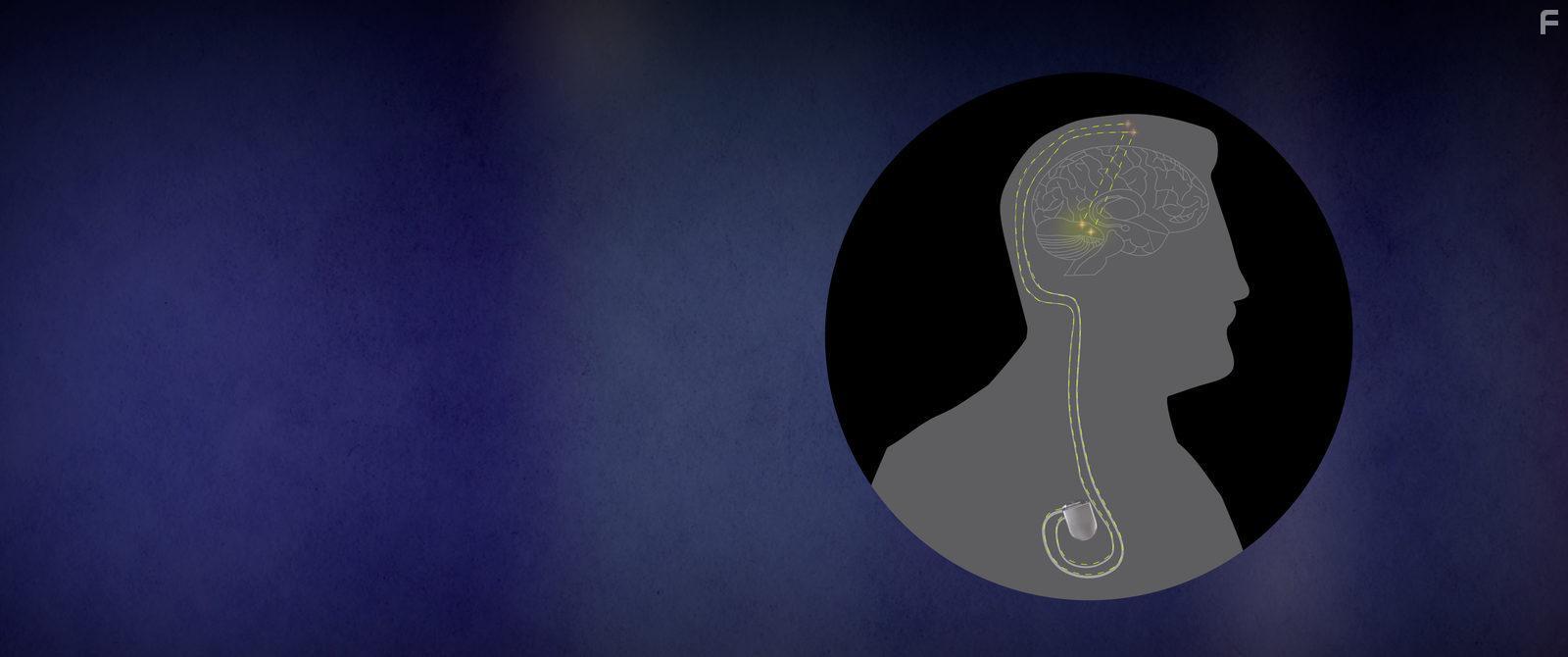 Чип внутри меня #5